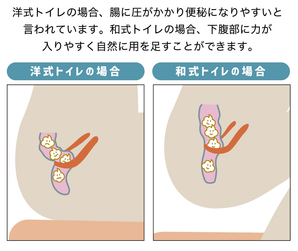 スッキリサポートトイレの踏み台:和式トイレの場合下腹部に力が入りやすく自然に用を足すことができる